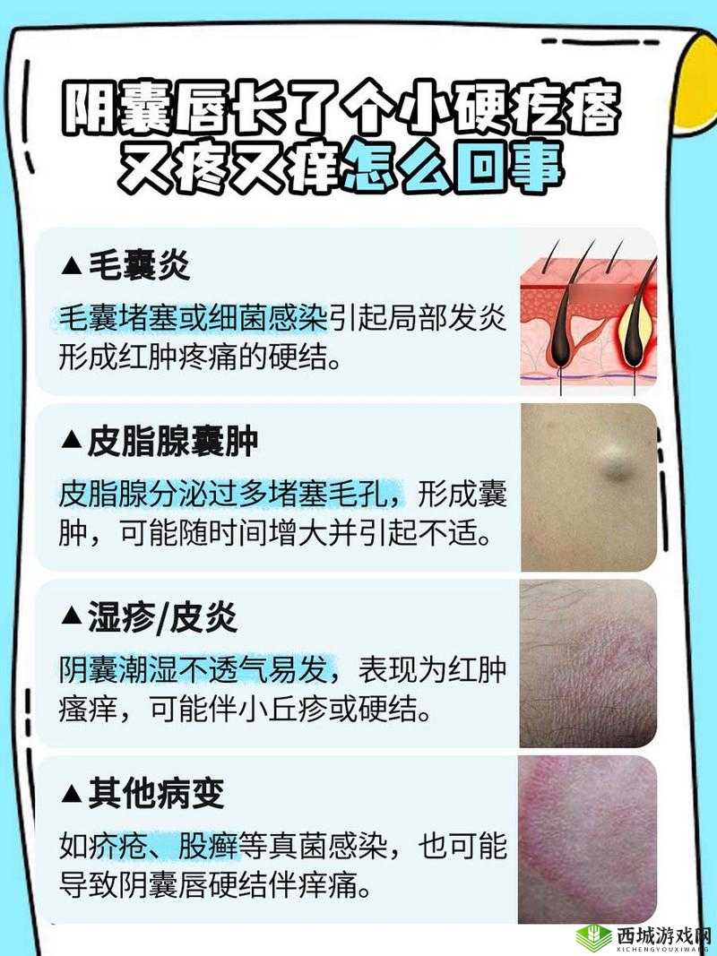 女性大阴囊唇内侧长了水泡,这是怎么回事?