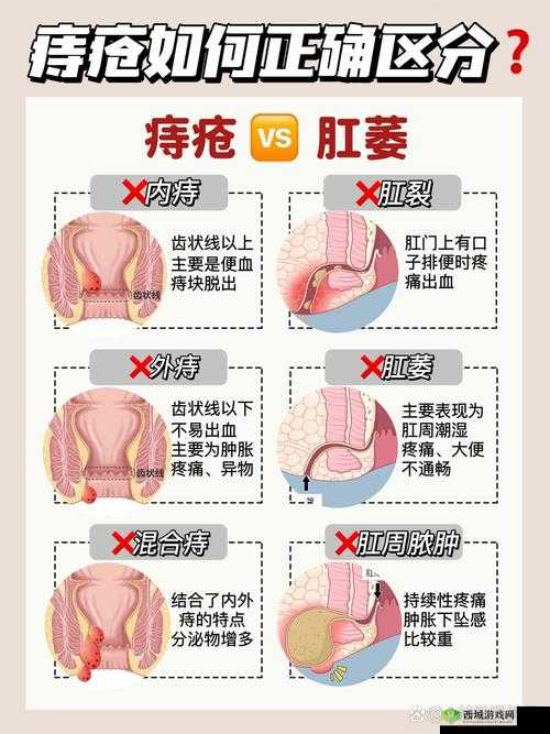 肛门口有个肉球突出是怎么回事:原因分析与应对方法探讨